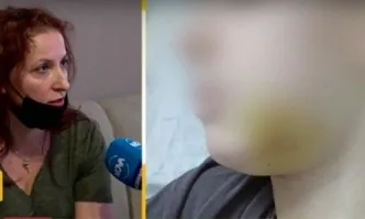 Отново агресия между деца: Ученик е със счупена челюст, след като бил пребит от друго дете